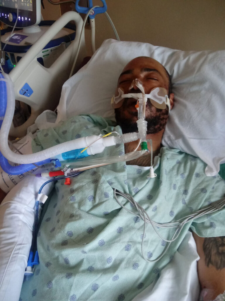 This photo provided by Rita Gowens shows her son, Demetrio Jackson, at the Sacred Heart Hospital in Eau Claire, Wis., in October 2021. Gowens spoke to him, held his hand and hoped for a miracle. She eventually agreed to remove him from a ventilator after his condition didn’t improve, singing into his ear as he took his final breaths: “You’ve never lost a battle, and I know, I know, you never will.” Photo credit: Rita Gowens via The Associated Press