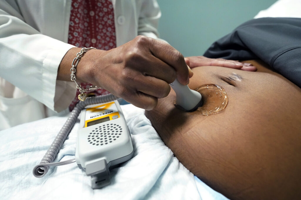 A doctor uses a hand-held Doppler probe on a pregnant woman to measure the heartbeat of the fetus on Dec. 17, 2021, in Jackson, Mississippi. Photo credit: Rogelio V. Solis, The Associated Press